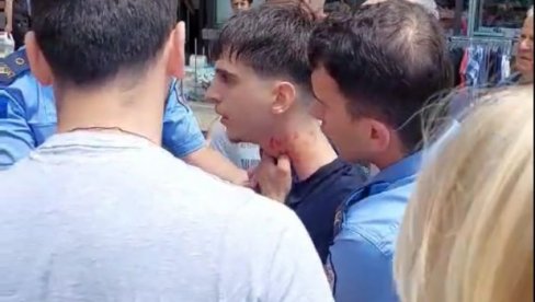 HVATAO GA ZA VRAT NANEVŠI MU POVREDE: Pripadnik tzv. kosove policije brutalno napao srpskog maturanta u Severnoj Mitrovici HVATAO GA ZA VRAT NANEVŠI MU POVREDE: Pripadnik tzv. kosove policije brutalno napao srpskog maturanta u Severnoj Mitrovici