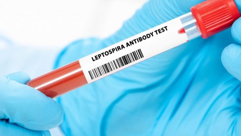 REGISTROVAN PRVI SLUČAJ LEPTOSPIROZE: Zarazna bolest potvrđena u Bijelom Polju
